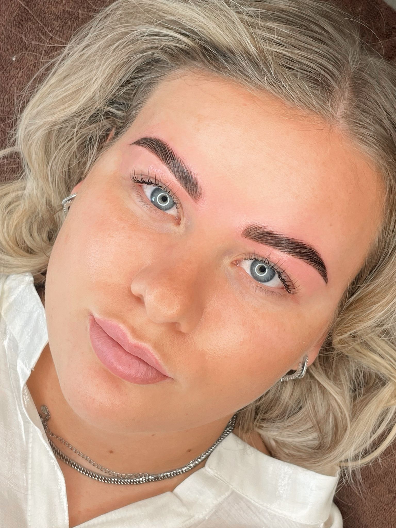 Volle wenkbrauwen na brow lift